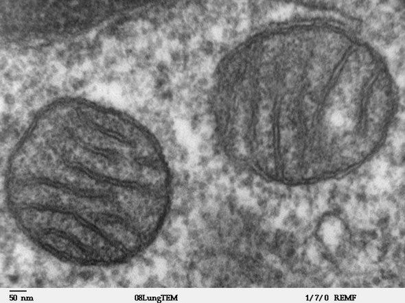 Electron microscopy shows two mitochondria from mammalian lung tissue displaying their matrix and membranes. Training in Zone 2 cardio can increase mitochondria number and efficiency.