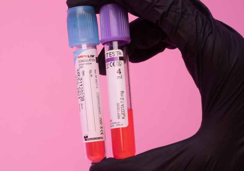 unrecognizable laboratory worker showing blood test tubes