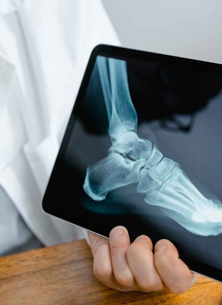 person holding an x ray result of a foot