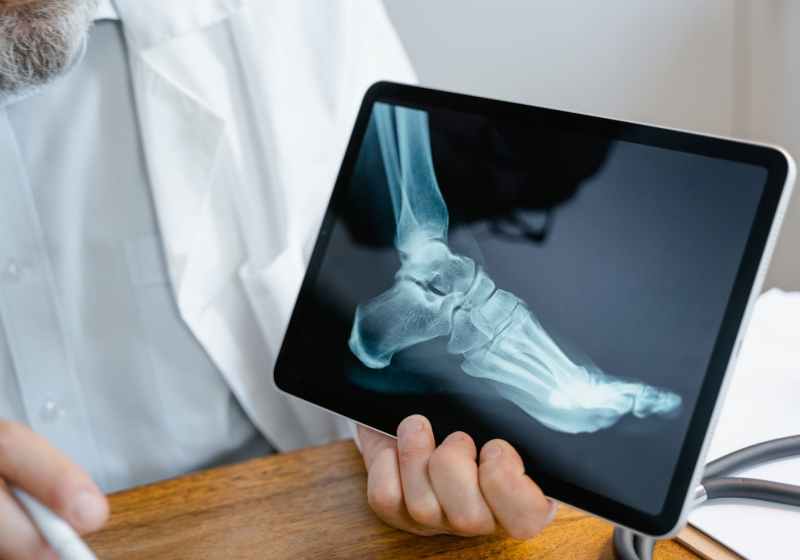 person holding an x ray result of a foot