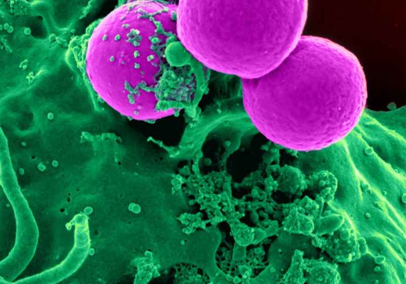 pink sphere splashed by green liquid
