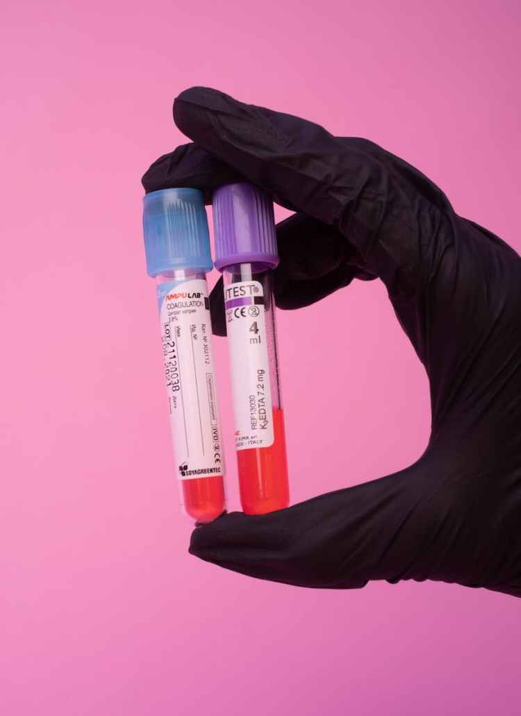 unrecognizable laboratory worker showing blood test tubes